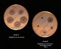 staphylococcus aureus